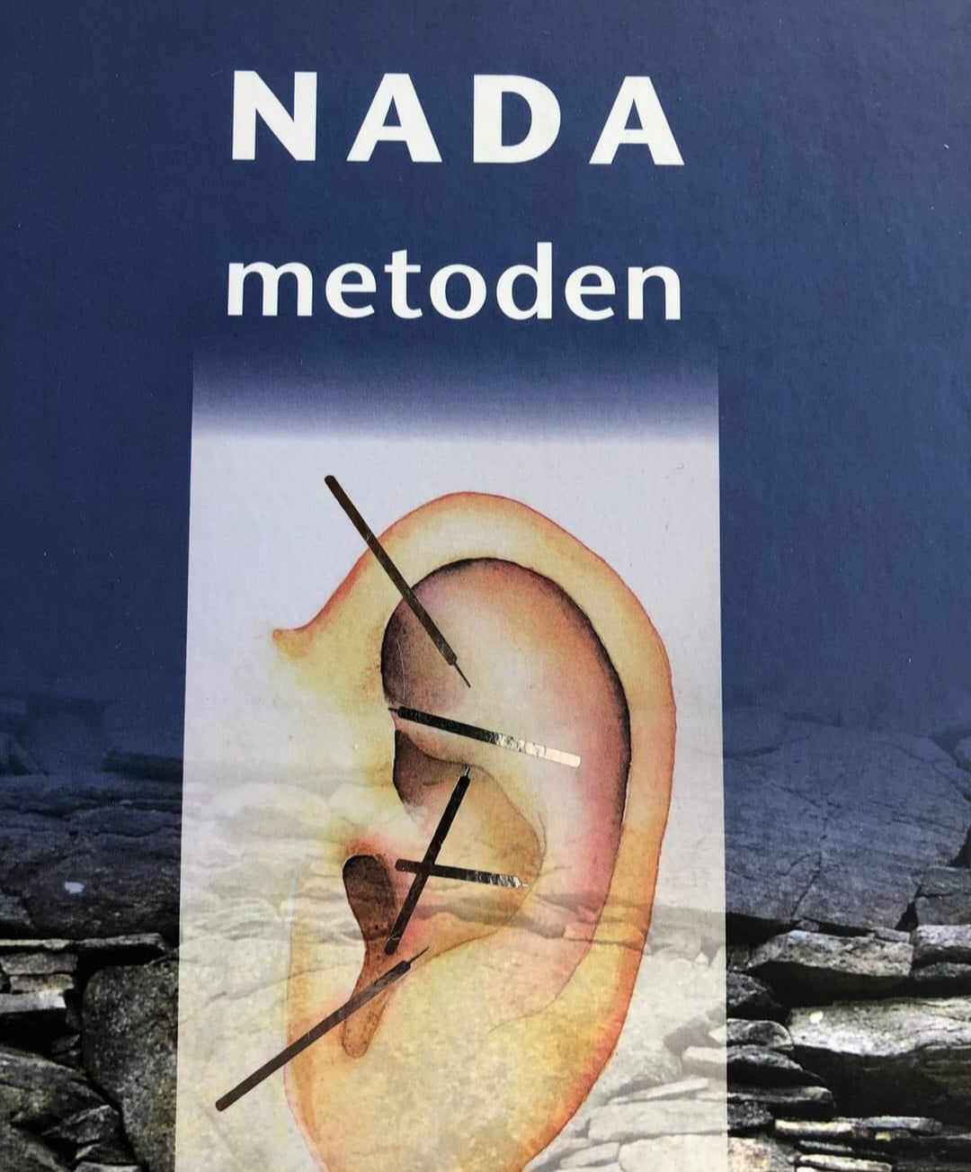 NADA Øreakupunktur